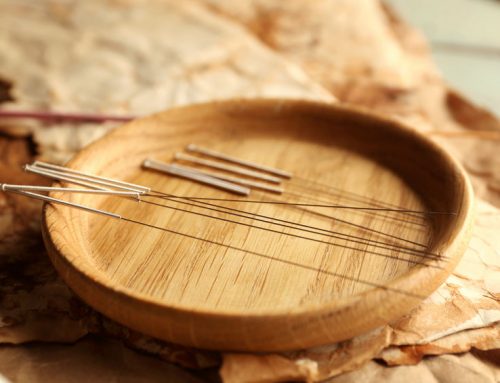 Acupuncture to Relieve Migraines and Tension